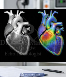افزوده شدن لایه رنگی به تصویر دوبعدی قلب برای نمایش جریان خون در اکو داپلر رنگی