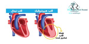 عضله قلب