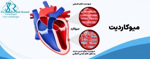 میوکاردیت