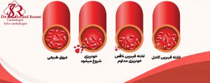 اختلالات انعقادی یا بیماری‌های خاص