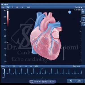 نمای اکوکاردیوگرافی جنین با نمایش واضح چهار حفره قلب در تونالیته صورتی و آبی