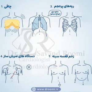 تصویر آموزشی شامل شرایط مختلف مثل چاقی، COPD شدید، پکتوس اکسکاواتوم، سیمهای پیسمیکر و زخم قفسه سینه که روی کیفیت اکو اثر میگذارند
