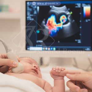 تصویر اکوکاردیوگرافی نوزاد با سوراخ بزرگ دهلیزی (ASD) و شانت چپ به راست در کنار دست نوزاد که انگشت مادر را گرفته است