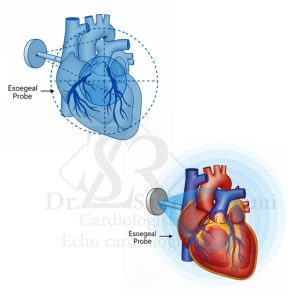 نمای مقایسه‌ای از اکو مری سه‌بعدی که وضوح بالاتر و دید کامل‌تری از حفرات و دریچه‌های قلب نسبت به اکو دوبعدی نشان می‌دهد و به تشخیص دقیق‌تر کمک می‌کند.