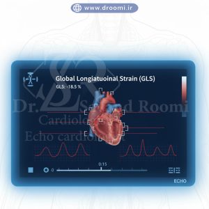 خطوط قرمز نشاندهنده تغییر شکل طولی در بطن چپ