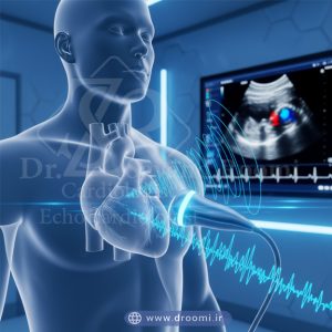 تصویر شماتیک نشاندهنده امواج پروب اکوکاردیوگرافی که به قلب میرسد و بازگشت آن به دستگاه برای تشخیص دقیق عملکرد قلب