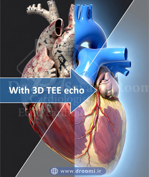 تصویر دو بخشی با قلب تیره و بیمار در سمت چپ و قلب روشن و سالم در سمت راست همراه با نمای 3D TEE و فلش انتقال به سمت درمان.