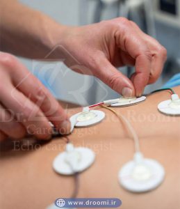 نمای نزدیک از پرستار در حال نصب الکترودهای سفید دایره‌ای هولتر قلب با ژل رسانا روی نقاط مشخص قفسه سینه بیمار در کلینیک مدرن.