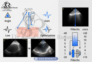 نمودار تخصصی وابستگی زاویه و تنظیم گین در Tissue Doppler Imaging