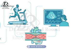 آیکون‌های قلب، تردمیل و رگ قلب برای نمایش عملکرد قلب، توان ورزشی و تشخیص ایسکمی در استرس اکو