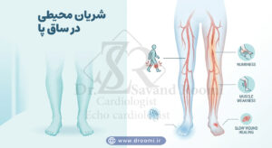 تصویر آموزشی از پاها با نشانه‌هایی مانند درد هنگام راه رفتن، سردی پا، زخم دیر بهبود و کاهش جریان خون