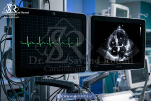 دو مانیتور پزشکی که یکی موج ECG و دیگری تصویر اکوکاردیوگرافی از حفرههای قلب را نمایش میدهد